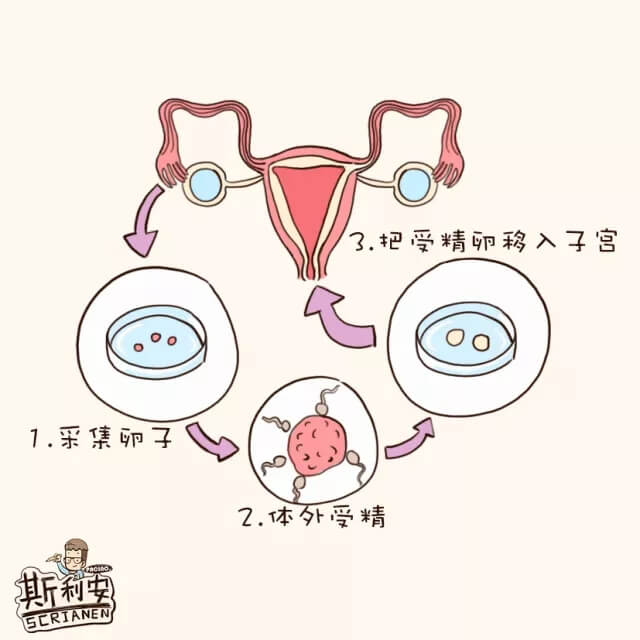 試管嬰兒 試管嬰兒